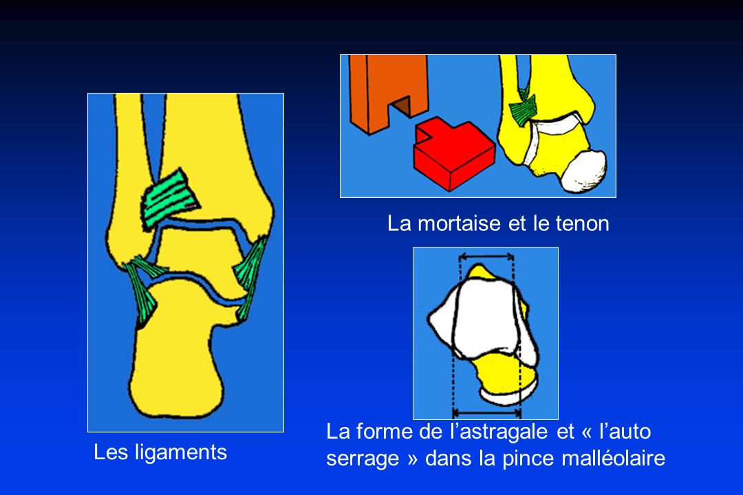 Traumatologie de la cheville ppt video online t l charger